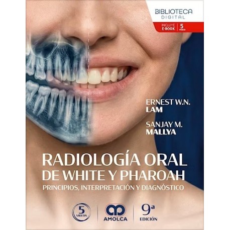 RADIOLOGIA ORAL DE WHITE Y PHAROAH. PRINCIPIOS, INTERPRETACION Y DIAGNOSTICO