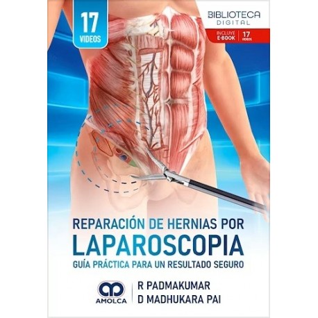 REPARACION DE HERNIAS POR LAPAROSCOPIA.GUIA PRACTICA PARA UN RESULTADO SEGURO