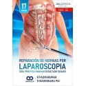 REPARACION DE HERNIAS POR LAPAROSCOPIA.GUIA PRACTICA PARA UN RESULTADO SEGURO
