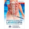 REPARACION DE HERNIAS POR LAPAROSCOPIA.GUIA PRACTICA PARA UN RESULTADO SEGURO