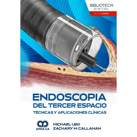 ENDOSCOPIA DEL TERCER ESPACIO.TECNICAS Y APLICACIONES CLINICAS
