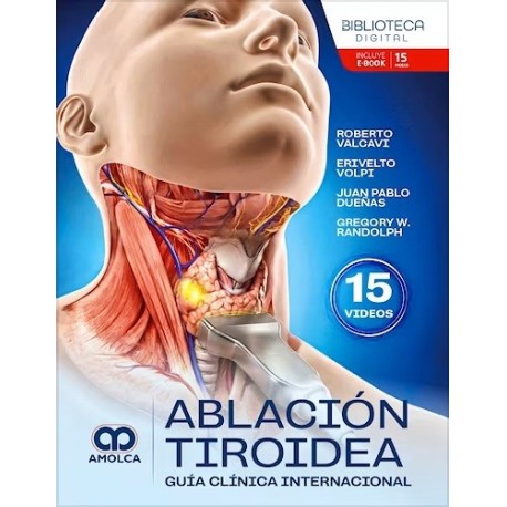 ABLACION TIROIDEA. GUIA CLINICA INTERNACIONAL