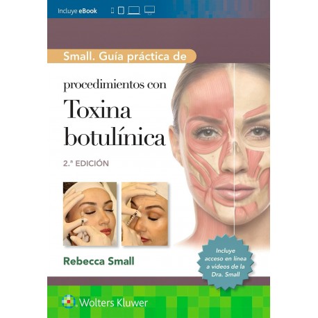 SMALL. GUIA PRACTICA DE PROCEDIMIENTOS CON TOXINA BOTULINICA