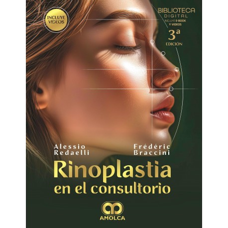 RINOPLASTIA EN EL CONSULTORIO