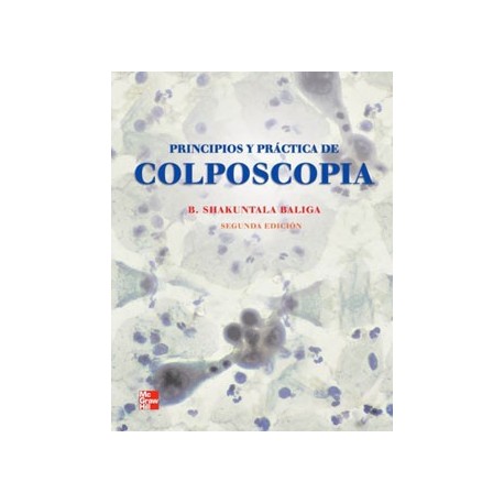 PRINCIPIOS Y PRACTICA DE LA COLPOSCOPIA