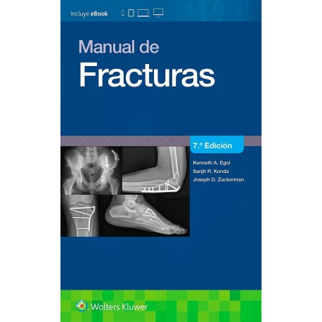MANUAL DE FRACTURAS