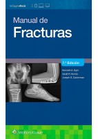 MANUAL DE FRACTURAS