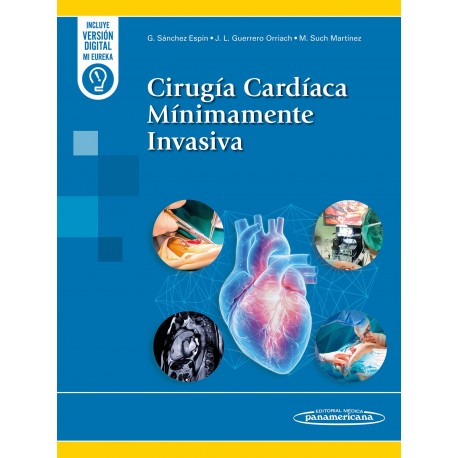 CIRUGIA CARDIACA MINIMAMENTE INVASIVA (INCLUYE VERSION DIGITAL MI EUREKA)