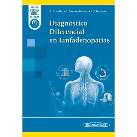 DIAGNOSTICO DIFERENCIAL EN LINFADENOPATIAS (INCLUYE VERSION DIGITAL MI EUREKA)