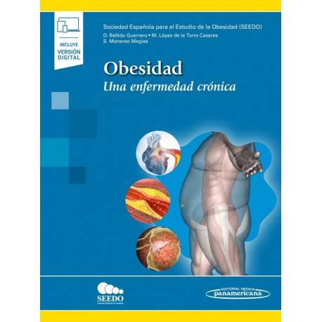 OBESIDAD. UNA ENFERMEDAD CRONICA (INCLUYE VERSION DIGITAL)
