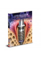 OSTEOINMUNOLOGIA APLICADA A LA IMPLANTOLOGIA