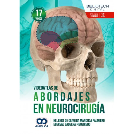 VIDEOATLAS DE ABORDAJES EN NEUROCIRUGIA