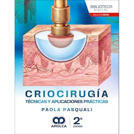 CRIOCIRUGIA. TECNICAS Y APLICACIONES PRACTICAS
