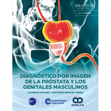 DIAGNOSTICO POR IMAGEN DE LA PROSTATA Y LOS GENITALES MASCULINOS