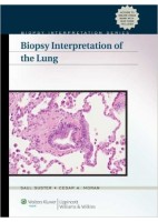 BIOPSY INTERPRETATION OF THE LUNG