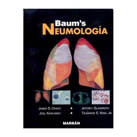 NEUMOLOGIA