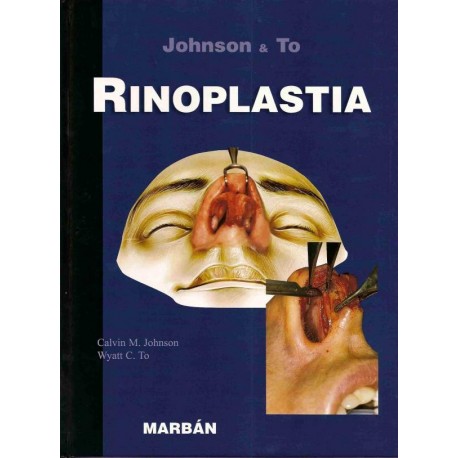 RINOPLASTIA