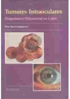 TUMORES INTRAOCULARES. DIAGNOSTICO DIFERENCIAL EN COLOR