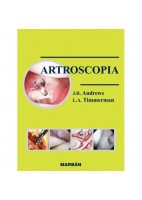 ARTROSCOPIA