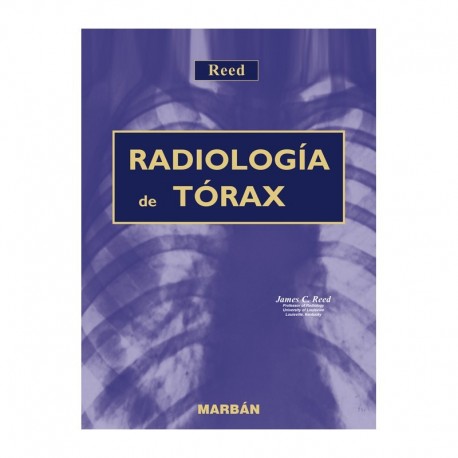 RADIOLOGIA DE TORAX. BOLSILLO