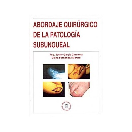 ABORDAJE QUIRURGICO DE LA PATOLOGIA SUBUNGUEAL