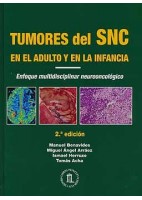 TUMORES DEL SNC EN EL ADULTO Y EN LA INFANCIA