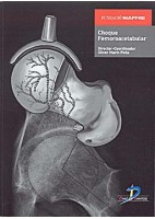 CHOQUE FEMOROACETABULAR