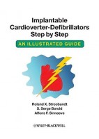 IMPLANTABLE CARDIOVERTER-DEFIBRILLATORS STEP BY STEP AN ILLUSTRATED GUIDE