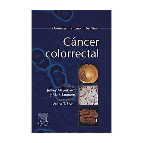 CANCER COLORRECTAL