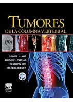 TUMORES DE LA COLUMNA VERTEBRAL
