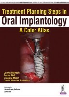 TREATMENT PLANNING STEPS IN ORAL IMPLANTOLOGY. A COLOR ATLAS