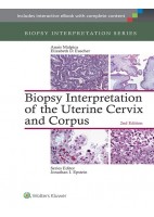 BIOPSY INTERPRETATION OF THE UTERINE CERVIX AND CORPUS