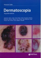DERMATOSCOPIA