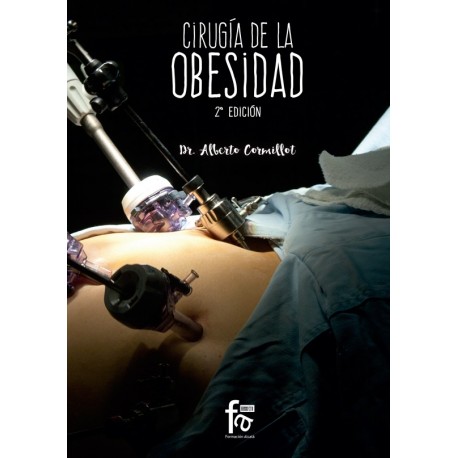 CIRUGIA DE LA OBESIDAD