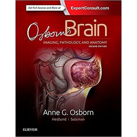 OSBON'S BRAIN. IMAGING, PATHOLOGY AND ANATOMY