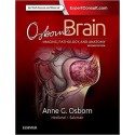 OSBON'S BRAIN. IMAGING, PATHOLOGY AND ANATOMY