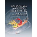 NEUROCIRUGIA FUNCIONAL Y ESTEREOTACTICA
