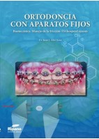ORTODONCIA CON APARATOS FIJOS. BIOMECANICA. MANEJO DE LA FRICCION. ORTHOSPEED SYSTEM