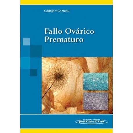 FALLO OVÁRICO PREMATURO