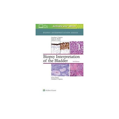 BIOPSY INTERPRETATION OF THE BLADDER