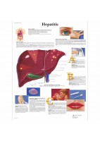 HEPATITIS (VR-3435)