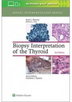 BIOPSY INTERPRETATION OF THE THYROID