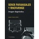 SENOS PARANASALES Y RINOFARINGE. IMAGEN DIAGNOSTICA