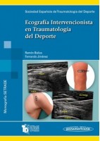 ECOGRAFIA INTERVENCIONISTA EN TRAUMATOLOGIA DEL DEPORTE (MONOGRAFIAS SETRADE)