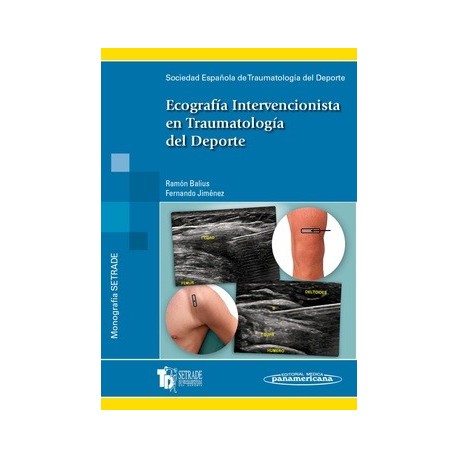 ECOGRAFIA INTERVENCIONISTA EN TRAUMATOLOGIA DEL DEPORTE (MONOGRAFIAS SETRADE)