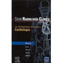 SERIE RADIOLOGIA CLINICA: 100 DIAGNOSTICOS PRINCIPALES EN CARDIOLOGIA