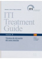 ITI TREATMENT GUIDE, VOL. 5: TECNICA DE ELEVACION DE SENO MAXILAR