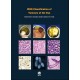 WHO CLASSIFICATION OF TUMOURS OF THE EYE