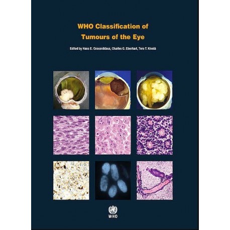 WHO CLASSIFICATION OF TUMOURS OF THE EYE