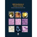 WHO CLASSIFICATION OF TUMOURS OF THE EYE